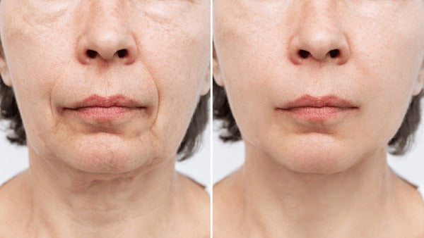 Cofultic Night Sleep Tightening Cream Flat Wrinkles